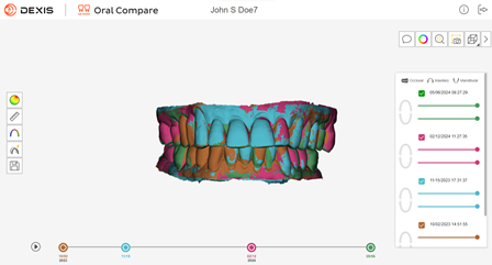 DEXISISScanFlowv1.0.11 OralCompare Superimpose 2