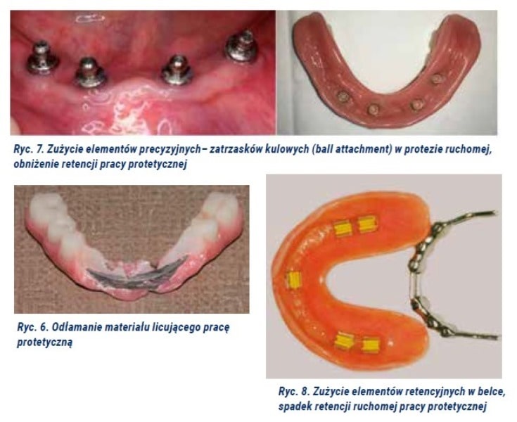 Implantologia 2