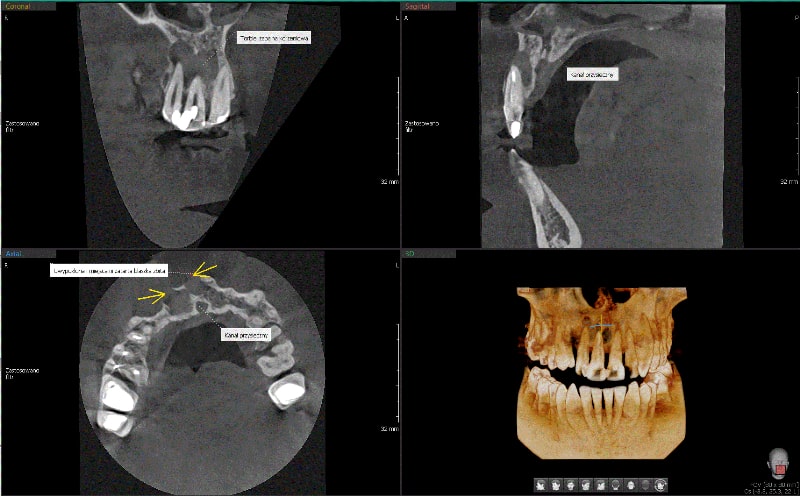 Radiologia 3D 