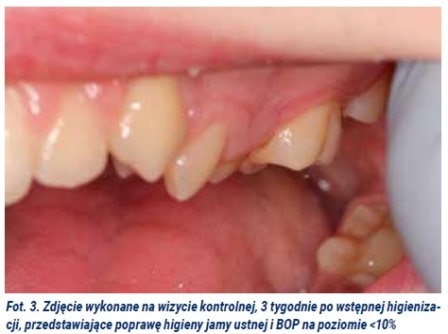 Elektryzująca skuteczność